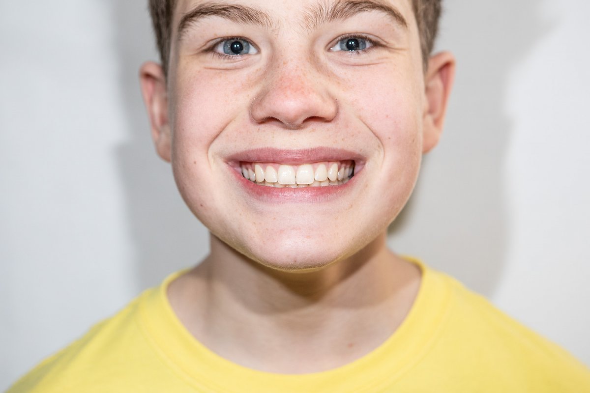 pearly whites