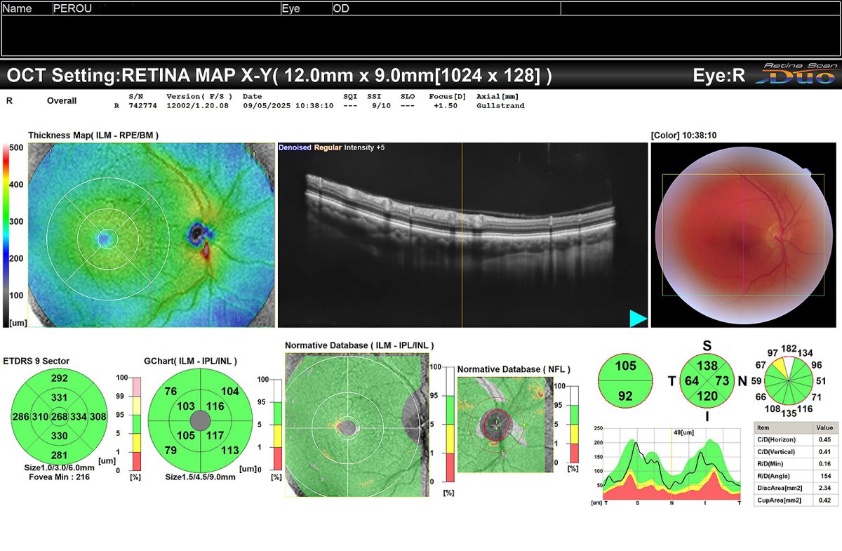 eye birthday