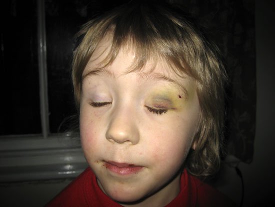 captain black eye