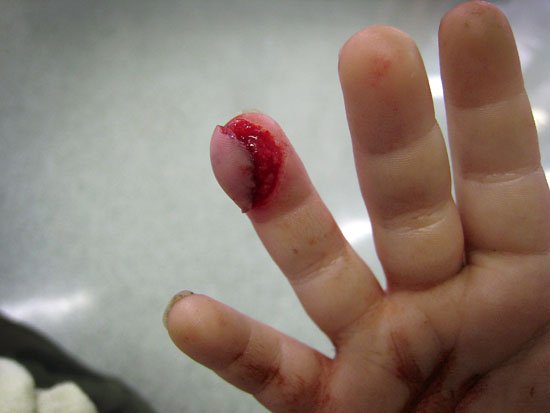 much ouch